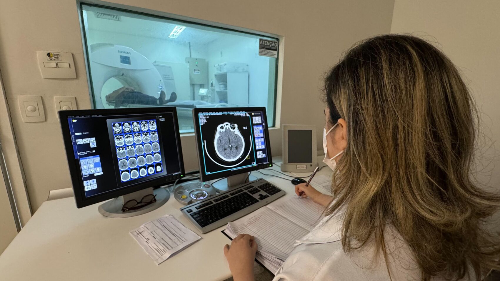 Neurologista comenta aumento de casos de AVC em jovens