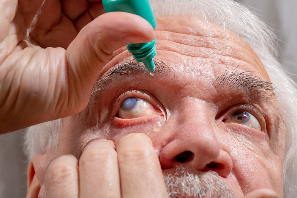 Uso indiscriminado de corticoides pode causar glaucoma e cegueira