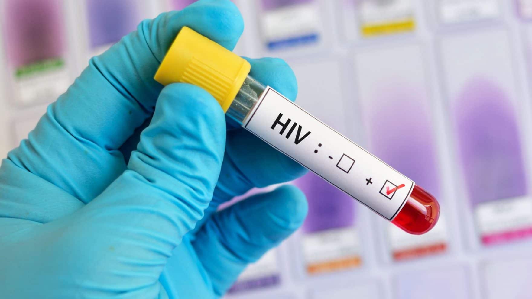 Desinformação sobre HIV dificulta tratamento e aumenta preconceito