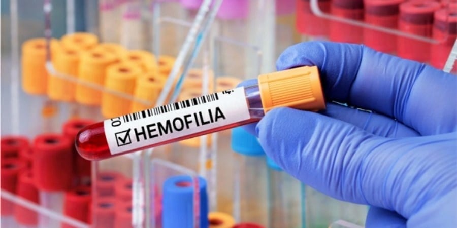 Hemofilia, o tratamento existe, mas não para todos